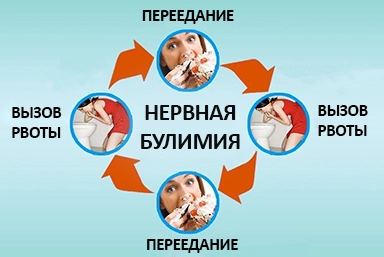 Лечение булимии в Балакирево